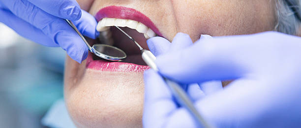 Best Emergency Dentist for Knocked-Out Tooth in Fayetteville, GA